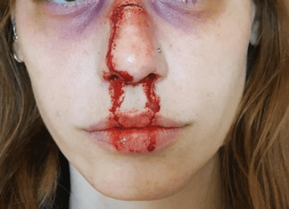 MULHER TENTA SE DEFENDER DE EX MARIDO E ACABA COM O NARIZ QUEBRADO EM QUIRINÓPOLIS