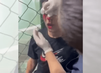 Cenas fortes: bomba explode em vestiário e perfura olho de jogador