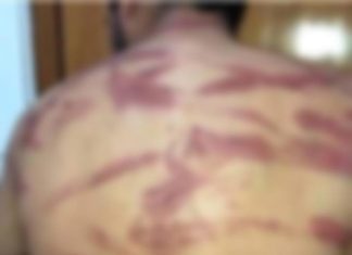 Homem agride esposa e é espancado pelo sogro em resposta à violência doméstica