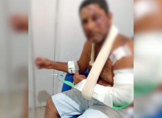Homem é atacado por onça, em Campinaçu; vídeo mostra os ferimentos