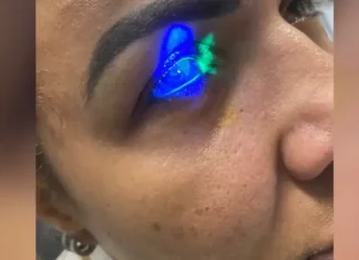 Mulher diz ter ficado cega após usar produto da marca de Virginia