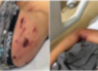 PIT BULL ATACA CRIANÇA QUE TENTAVA PEGAR PIPA