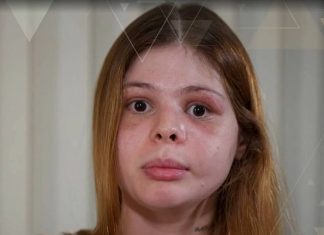 Médica espancada por namorado em São Paulo diz que ele ficou com ciúme de homem gay