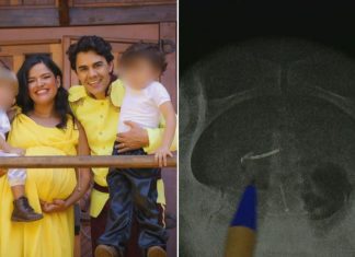MÃE ENCONTRA DIU NA BARRIGA ANOS DEPOIS DE TER ENGRAVIDADO USANDO O ANTICONCEPCIONAL