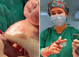 MÃE QUE ENGRAVIDOU USANDO DIU DESCOBRIU BEBÊ EM EXAME DE ROTINA