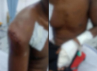 DISCUSSÃO EM SERRANÓPOLIS TERMINA COM HOMEM ESFAQUEADO PELA EX-COMPANHEIRA