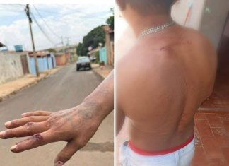 BRIGA DURANTE BEBEDEIRA TERMINA COM HOMEM ESFAQUEADO NAS COSTAS