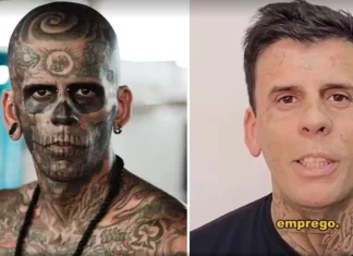“Homem mais tatuado do Brasil” surpreende ao aparecer quase irreconhecível após sessões de remoção de tatuagens no rosto